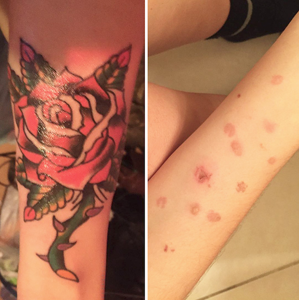 rose tattoo growth