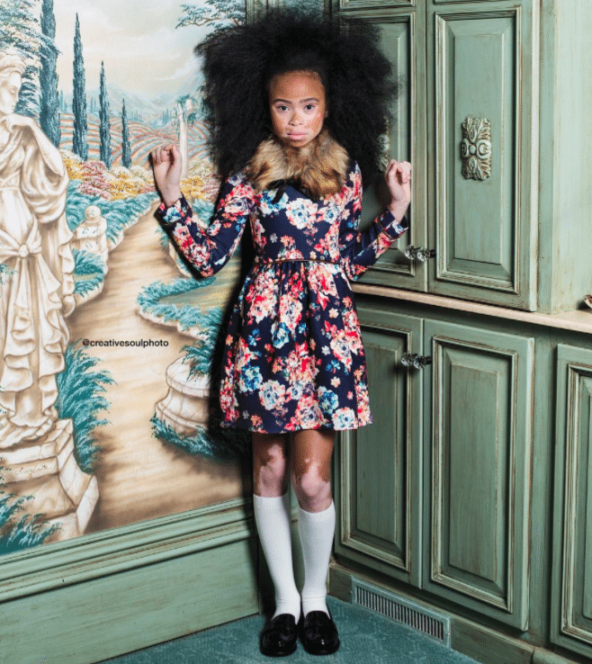 Winnie Harlow Surprises 10-Year-Old April Star With A Photo Shoot...And ...