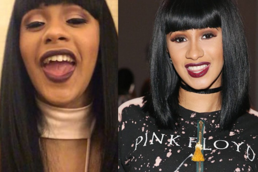 cardi teeth fixed smile before veneers she got influencers give perfect facts crooked having cost getting known worth