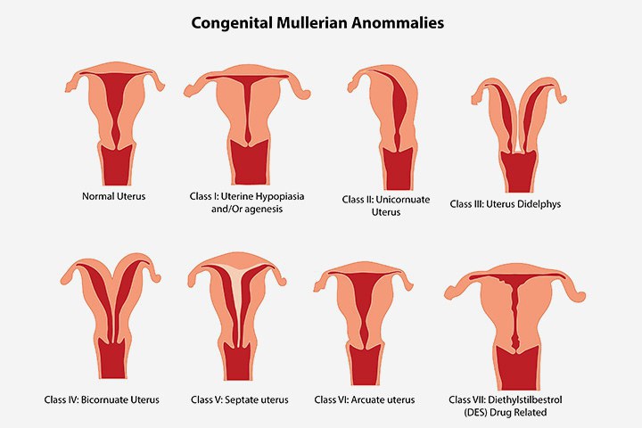 Severe Menstrual Cramps Are A Legitimate Excuse