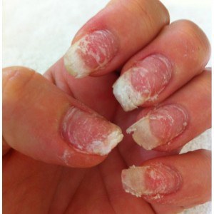 Only People With Acrylic Nails Will Understand Even Though Your Acrylic Nails Are On Fleek You Can T Help But Feel A Little Bad For Real Underneath