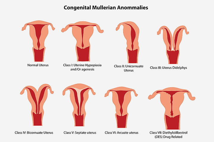 swollen-uterus