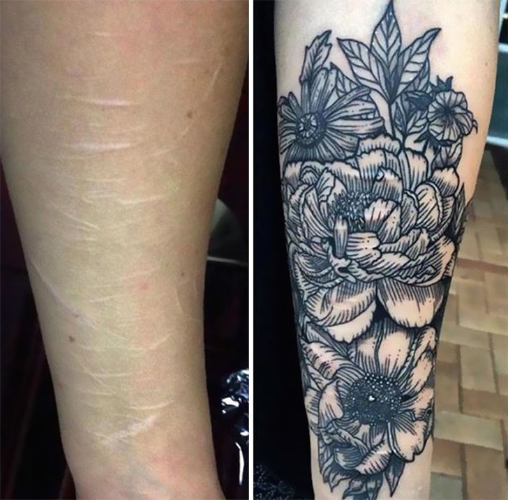 Schöne Tattoos, die dazu dienen, Narben aus der Vergangenheit zu