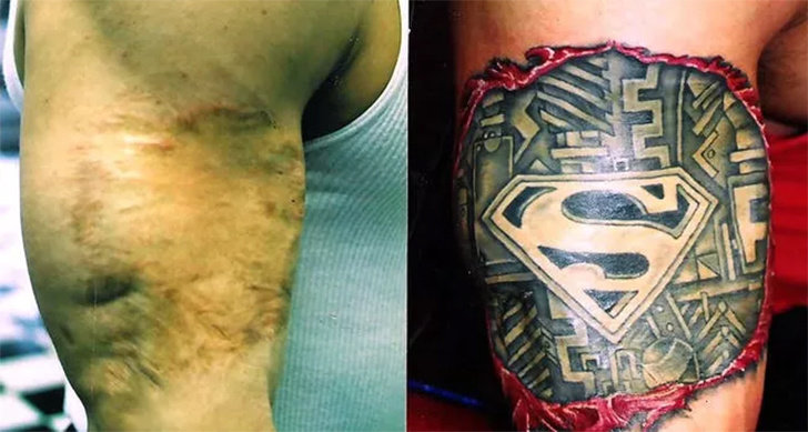 Schöne Tattoos, die dazu dienen, Narben aus der Vergangenheit zu