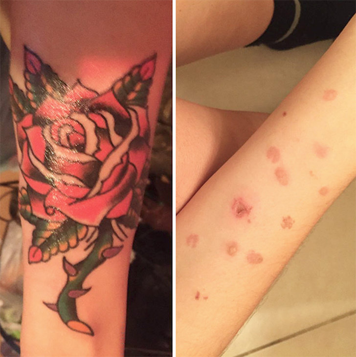 Schöne Tattoos, die dazu dienen, Narben aus der Vergangenheit zu