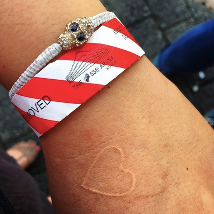 Schöne Tattoos, die dazu dienen, Narben aus der Vergangenheit zu