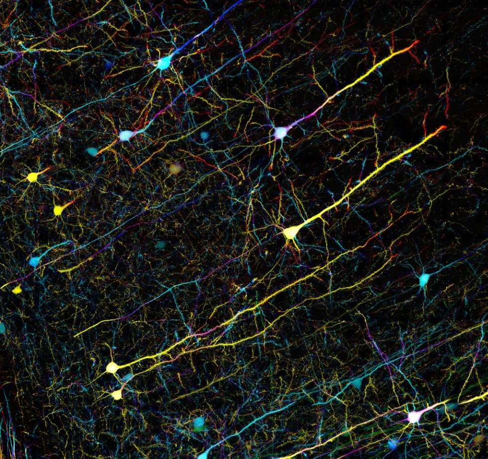 neurons in human brain