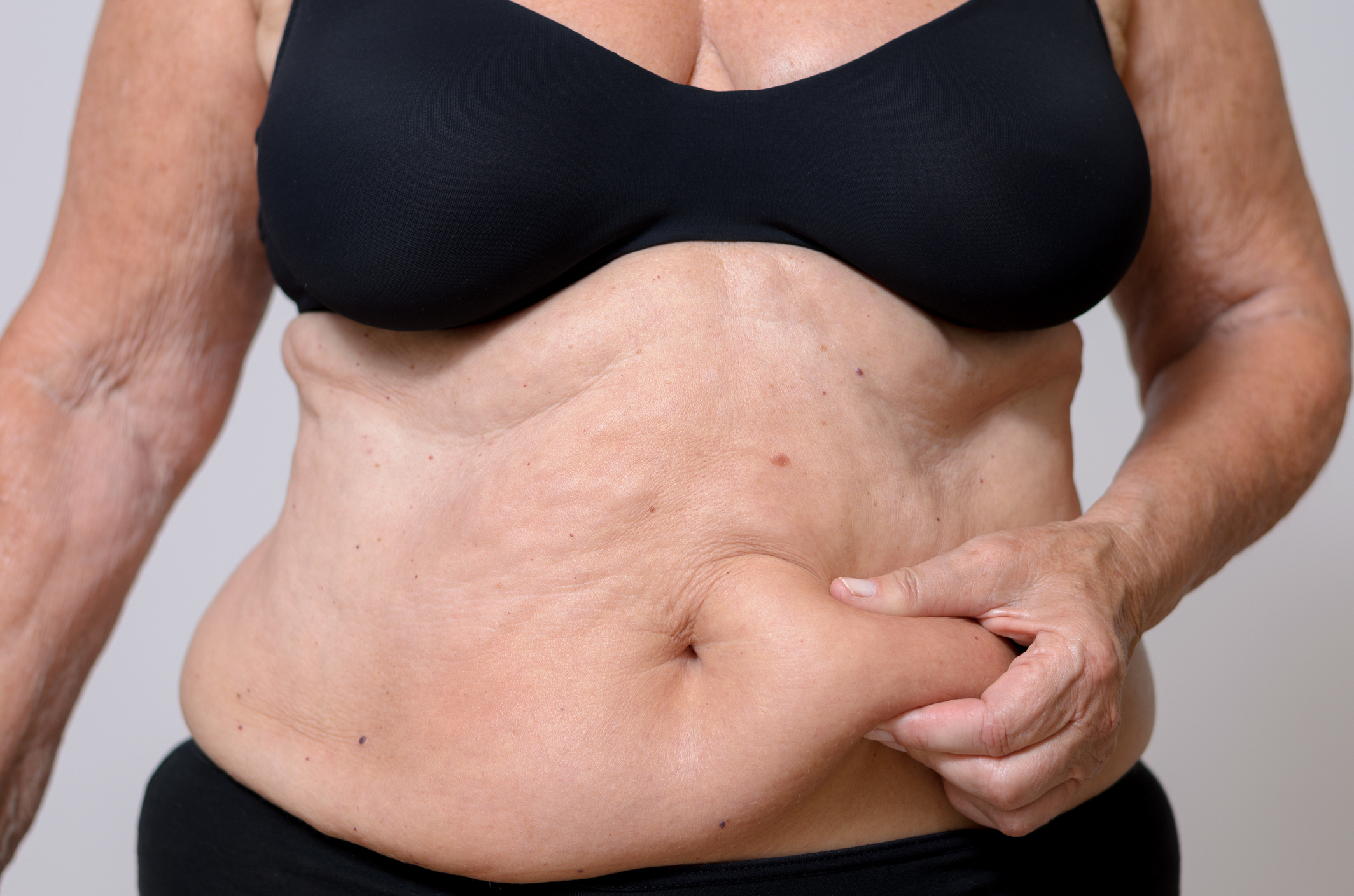 Belly Fat More Dangerous In Older Women Than Being Overweight Healthywomen