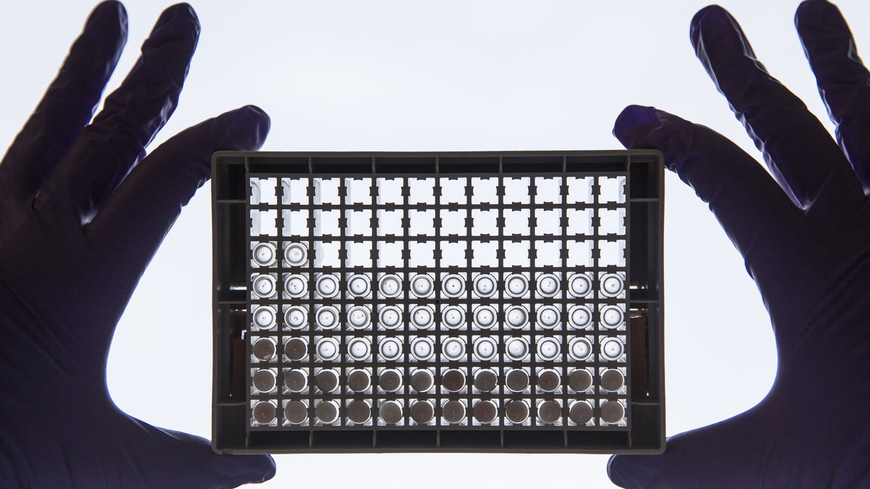 In Breakthrough Researchers Detect >> Flipboard Medical Breakthrough Researchers Believe A Simple Blood In Breakthrough Researchers Detect >> Flipboard Medical Breakthrough Researchers Believe A Simple Blood