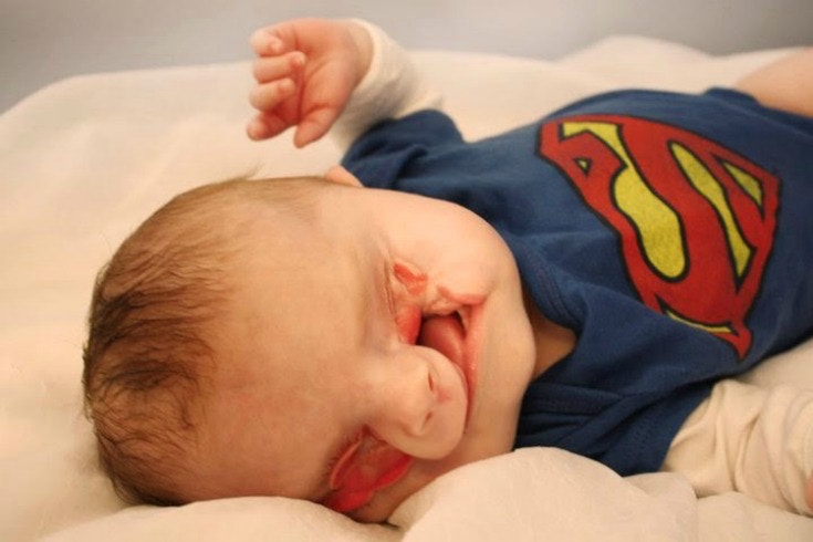 He Has One Of The World S Rarest Birth Defects Here S What The Experience Taught His Mom Upworthy