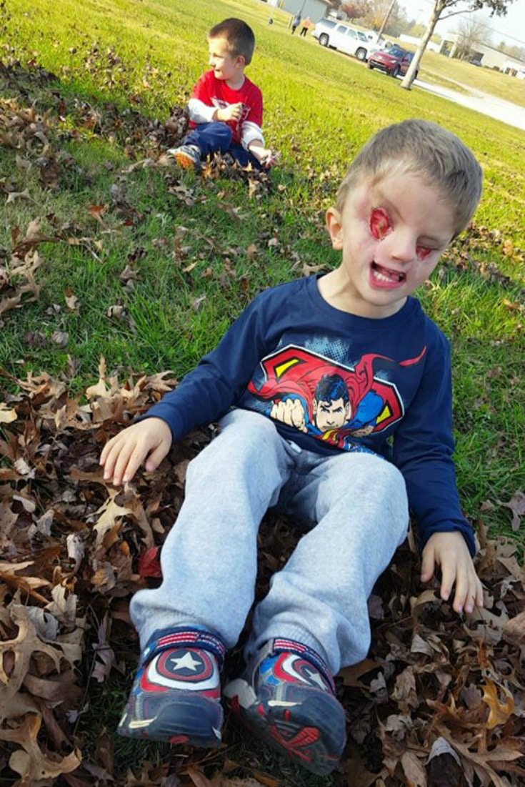 He Has One Of The World S Rarest Birth Defects Here S What The Experience Taught His Mom Upworthy