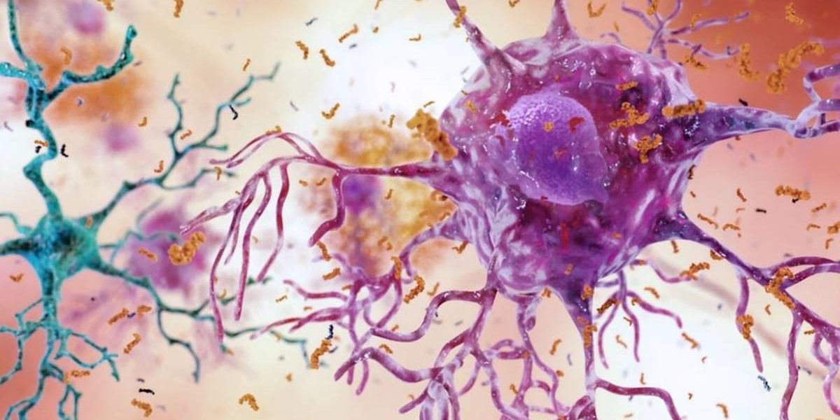 A mother-and-daughter team have developed what may be the world's first Alzheimer’s vaccine.