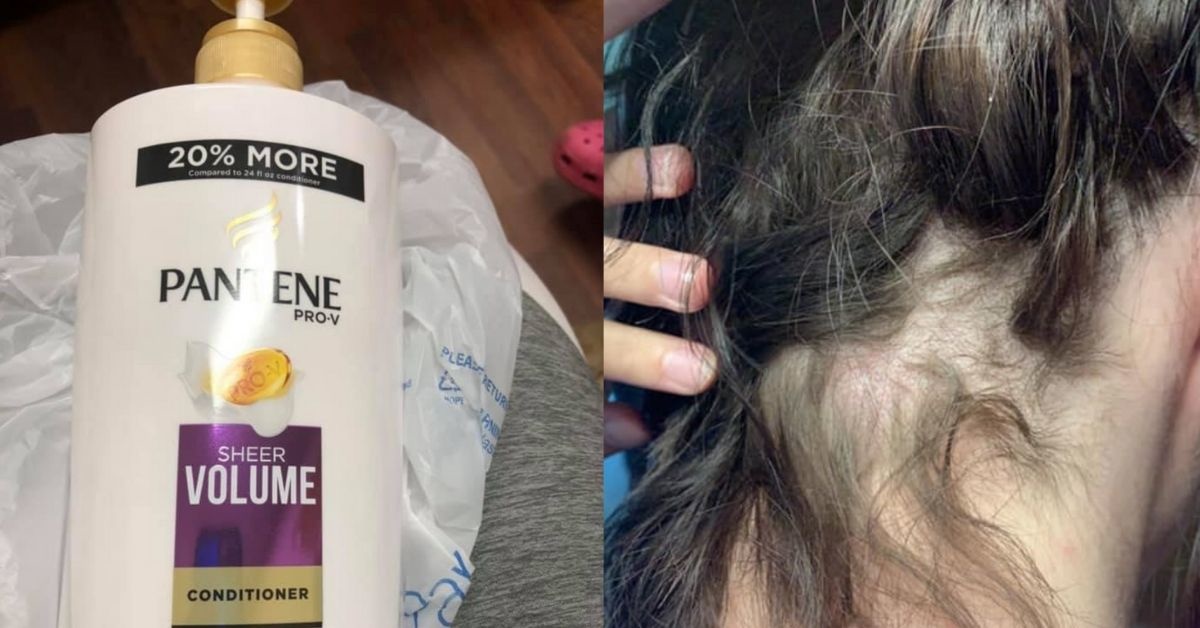 Flipboard Wisconsin Woman S Hair Falls Out After Buying