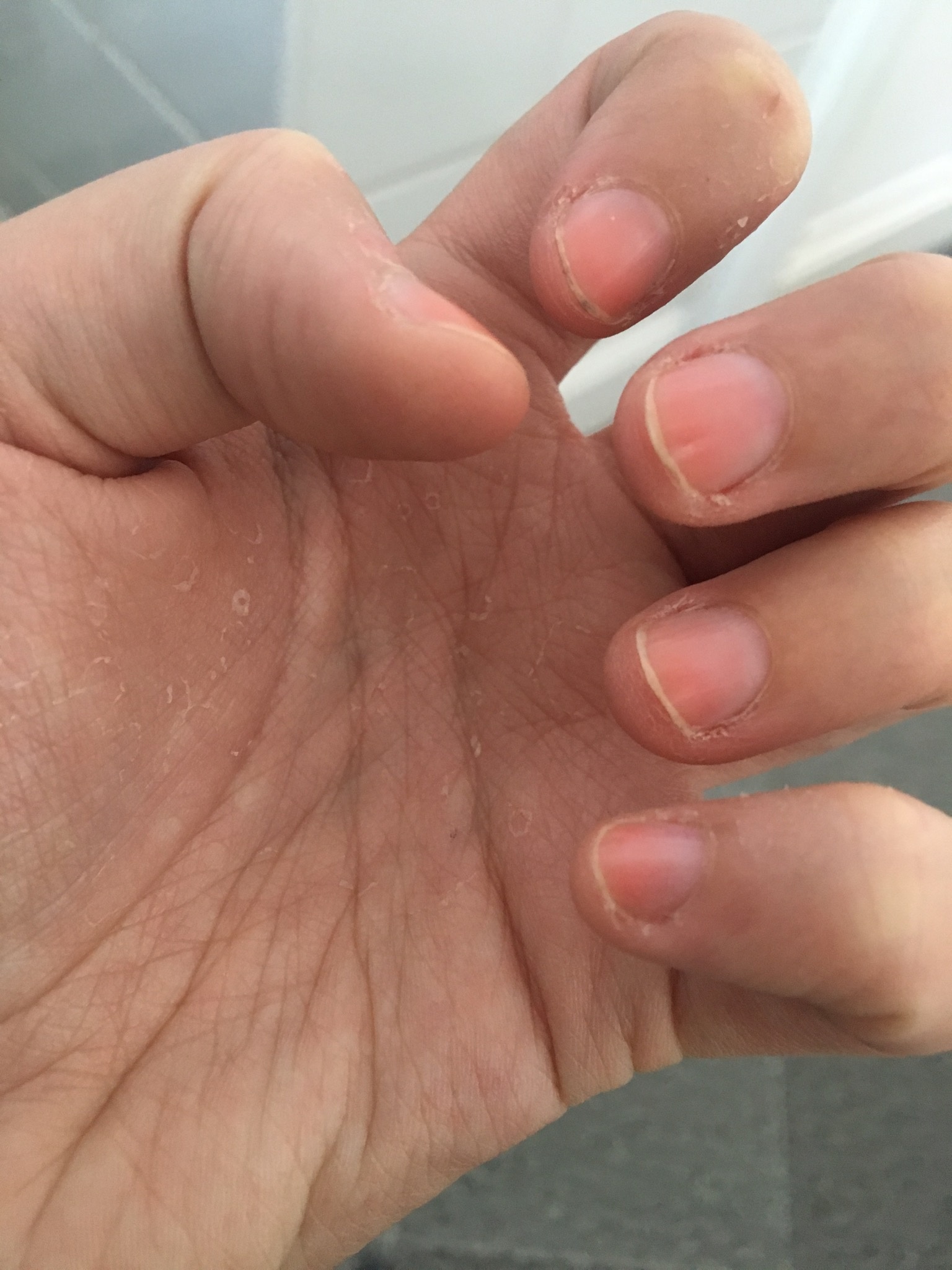How to stop biting your nails - B+C Guides