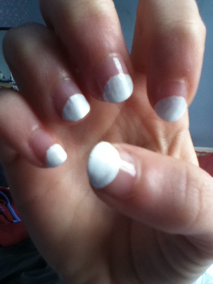 Aggregate more than 139 uneven white part of nail ceg.edu.vn