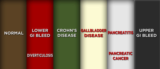 Human Stool Color Chart Adults Jake Film Analysis