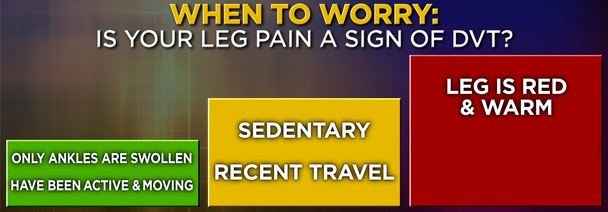 Leg Pain Chart