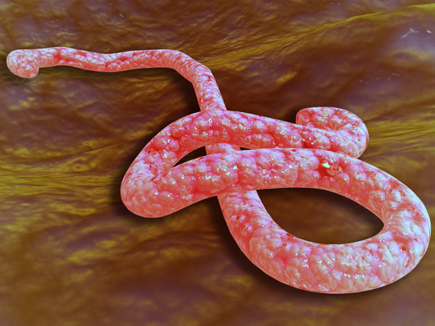 Understanding The Ebola Virus Ars Technica