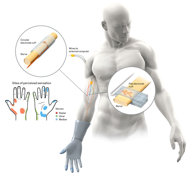 Creating a Prosthetic Hand That Can Feel - IEEE Spectrum