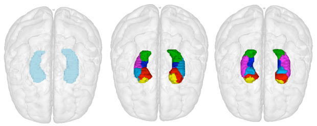 The Human Brain Project Reboots: A Search Engine for the