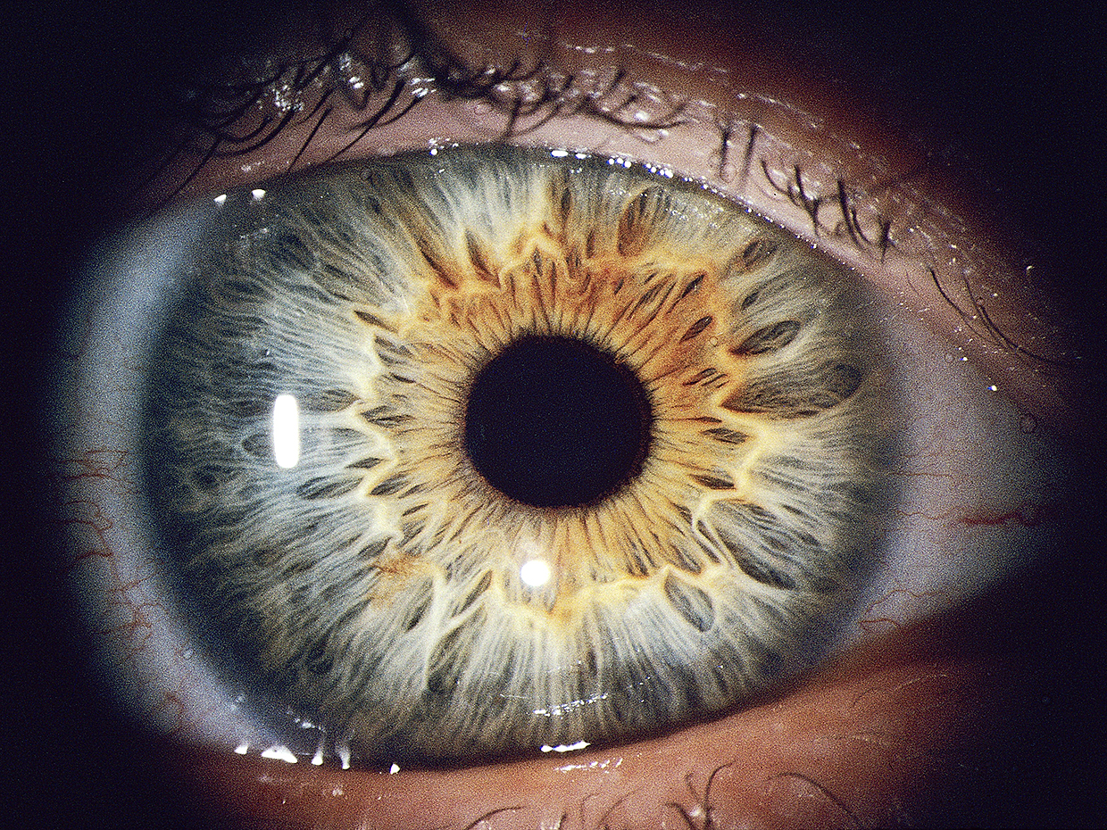 Unlocking the Mystery of Iris Recognition