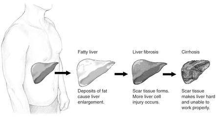 liver diagram