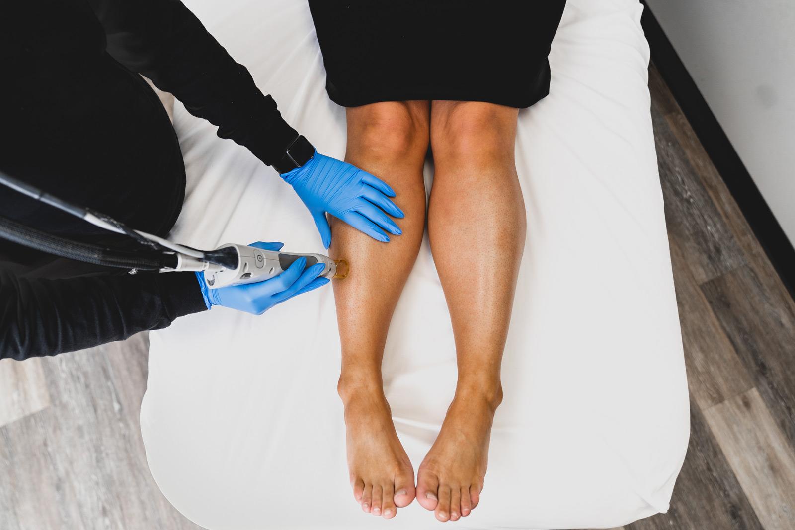 Is laser hair removal worth getting The experts break it down