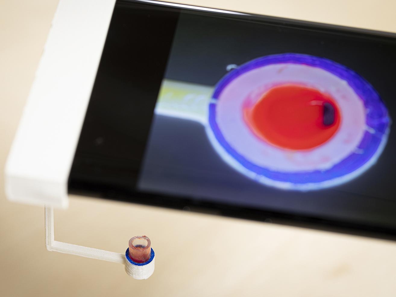 Blood Test Only Needs a Smartphone for Results - IEEE