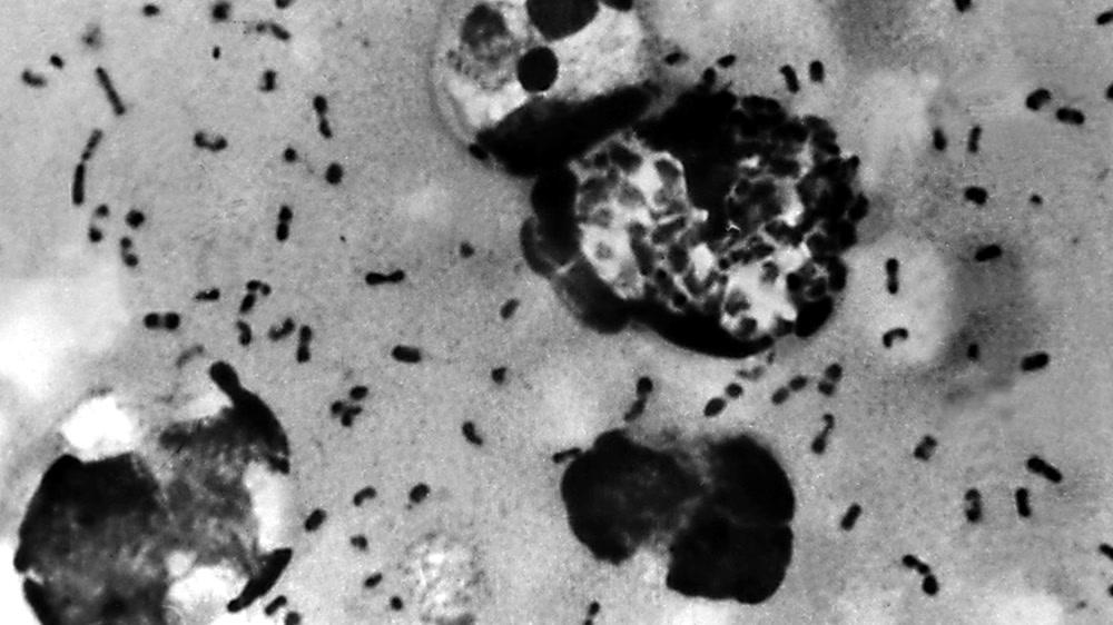 What is going on with Strep A and scarlet fever in the UK?