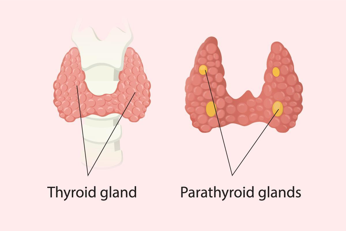 hypoparathyroidism