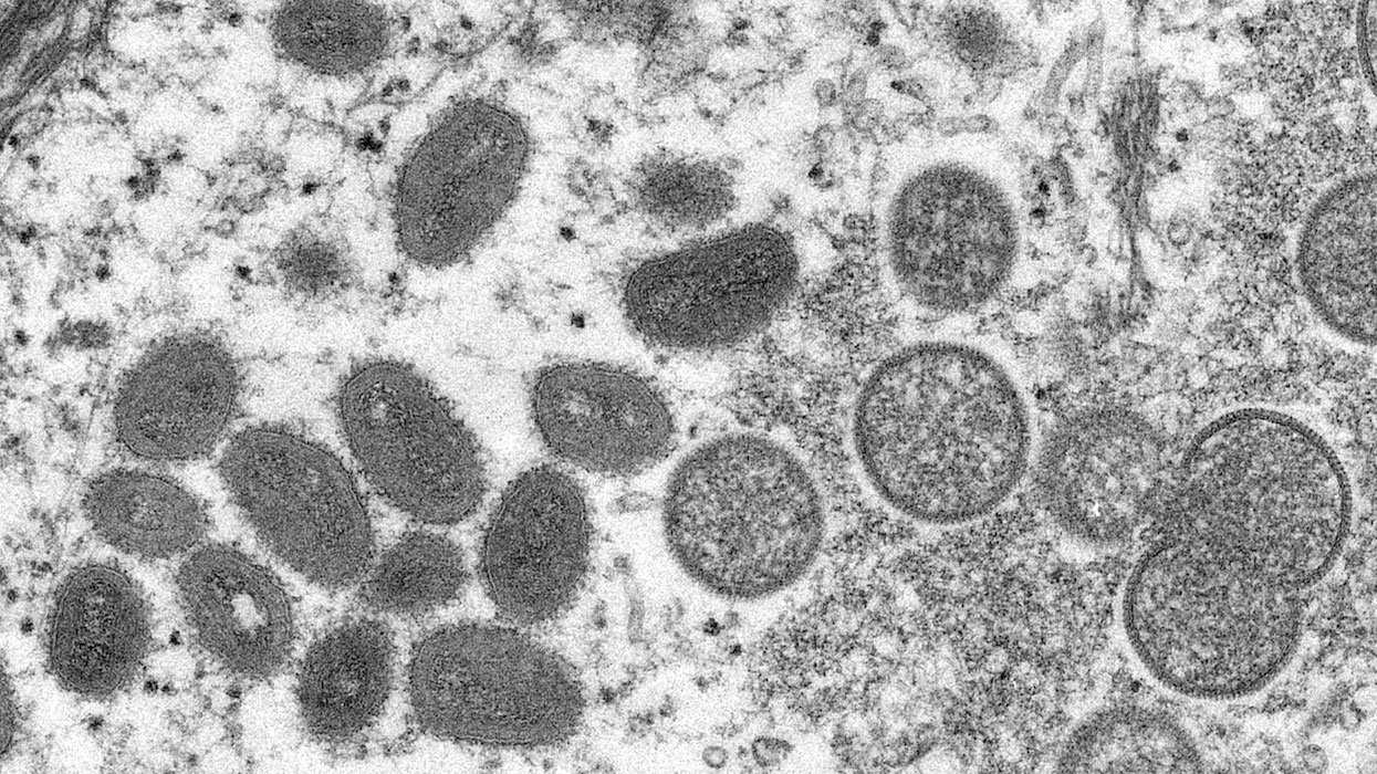 Mpox