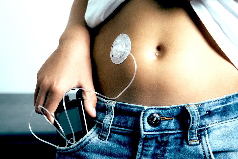 Implants like pacemakers and insulin pumps often fail because of