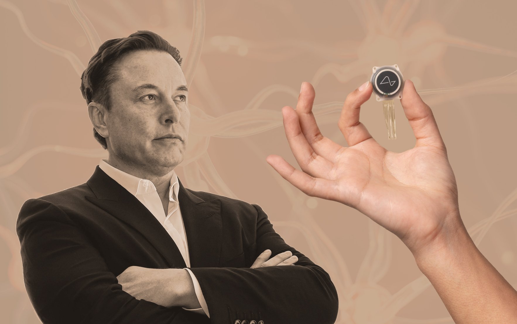 Elon Musk says his startup Neuralink has implanted a device in its