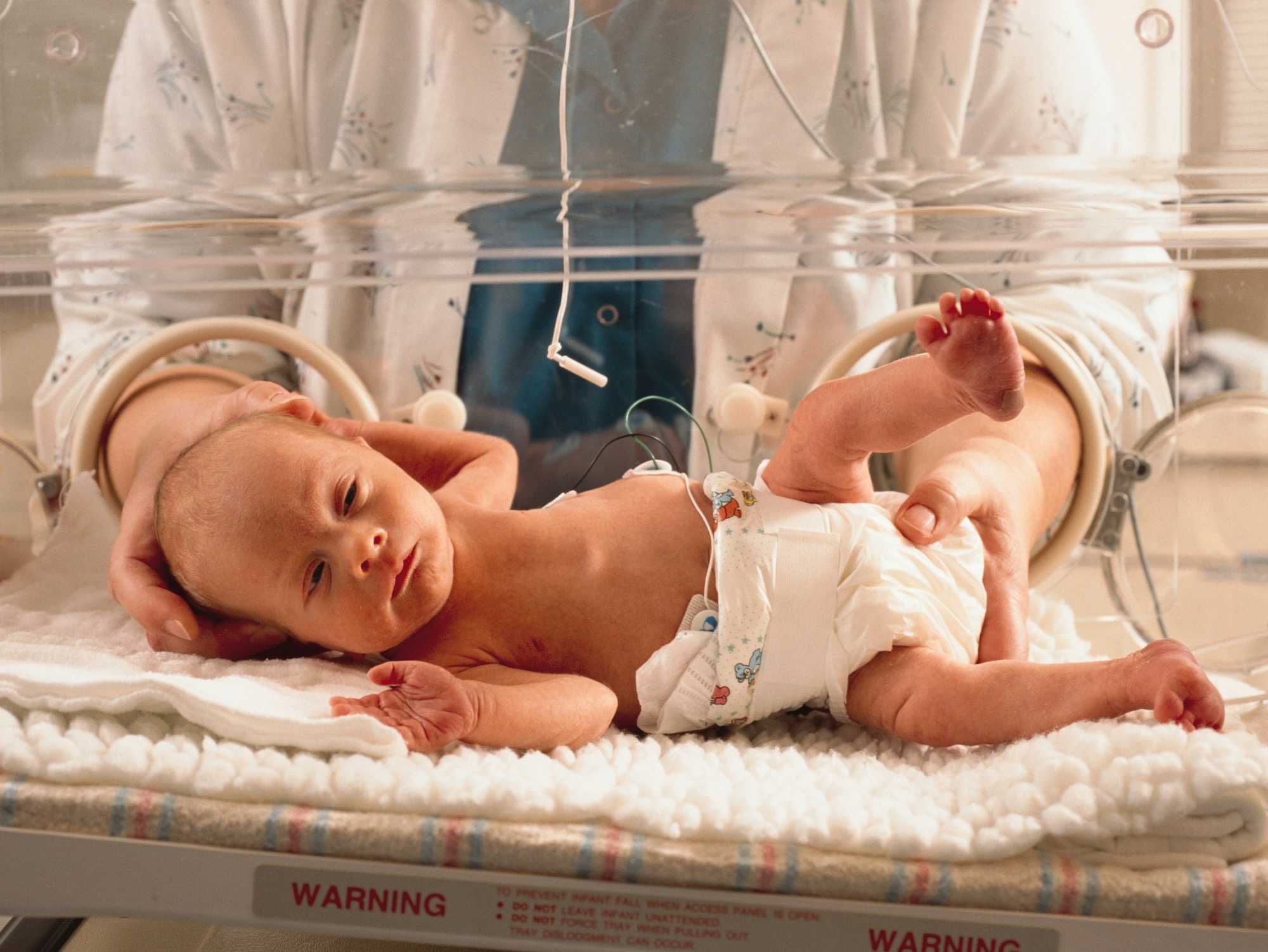 Phthalate plastic chemicals linked to nearly 4 million premature births in one year