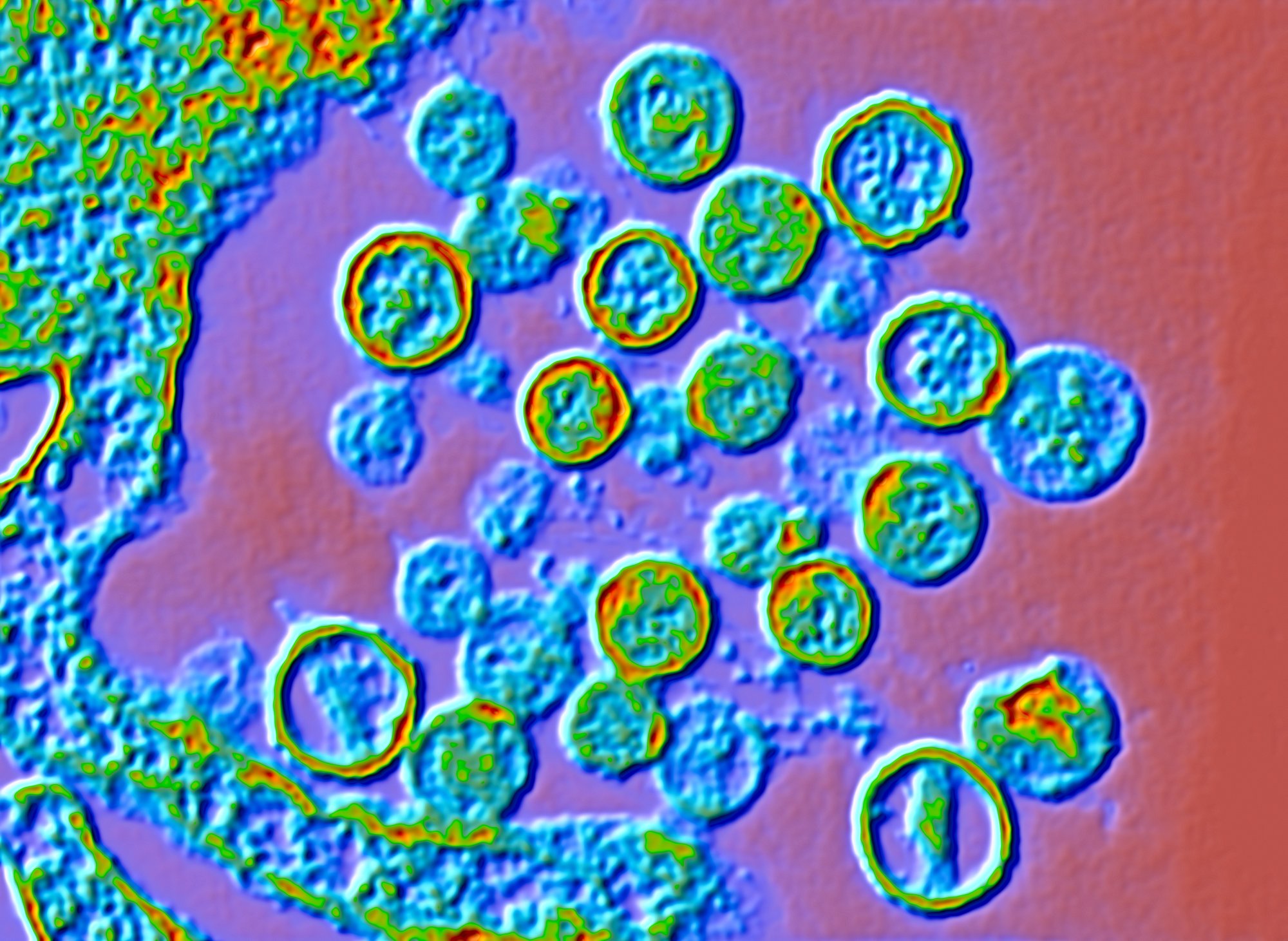 Scientists sequence deadly cruise ship virus as outbreak mystery deepens