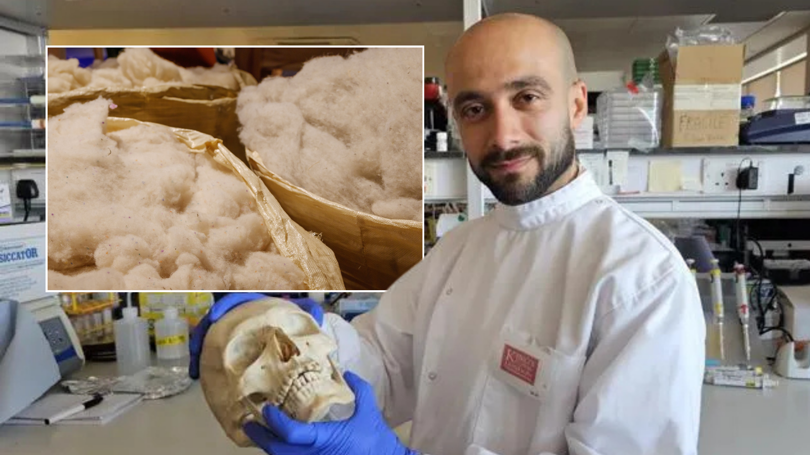 Scientists at UK university turn sheep wool into bone-healing material