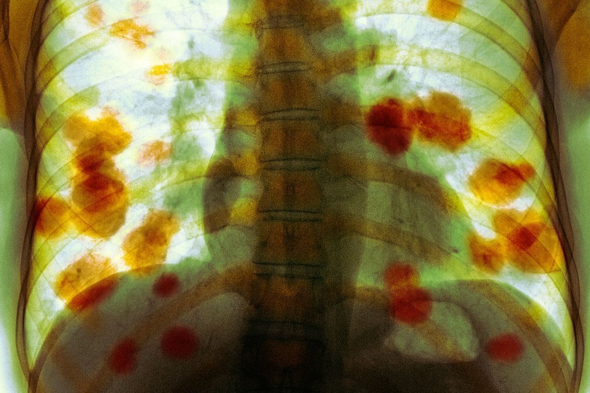 Common sleep symptom could signal cancer in some cases, doctor warns