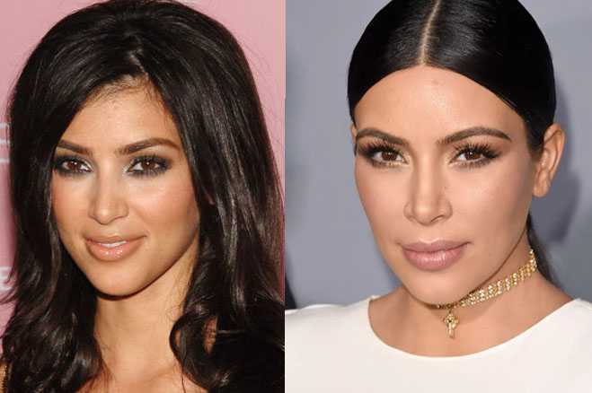 How Real Are The Kardashianskimplastic Fantastic Or Au