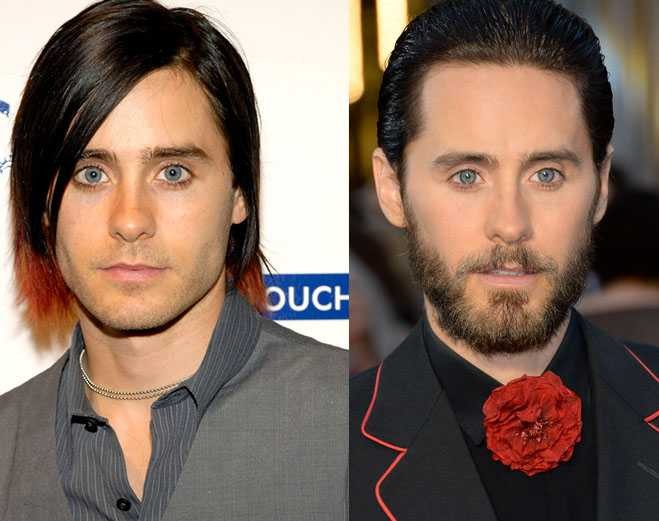 What Has Jared Leto Done To His Face—Plastic Fantastic Or Au Naturel ...