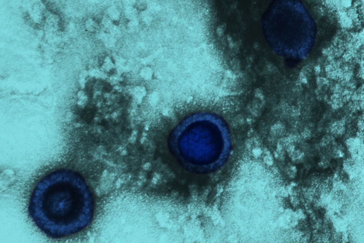 Health chiefs sound alarm as genital herpes infections rise across England