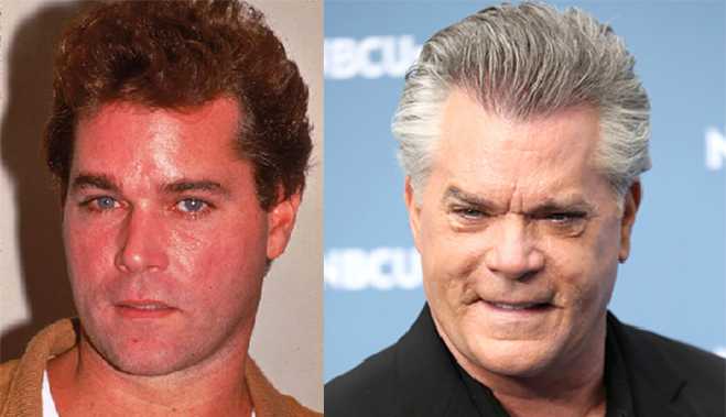 Changing Face Of Ray Liotta Plastic. 