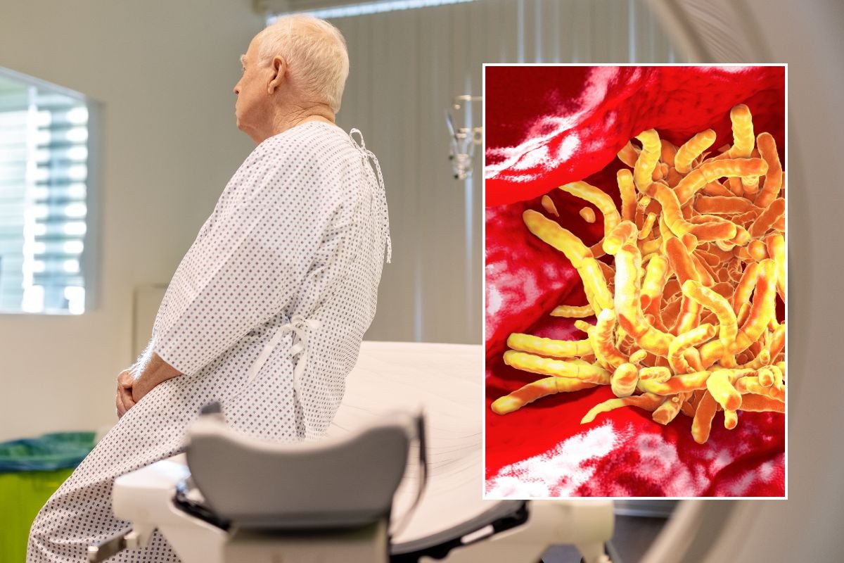 Older British men are most at risk of dying from tuberculosis that doctors fail to spot