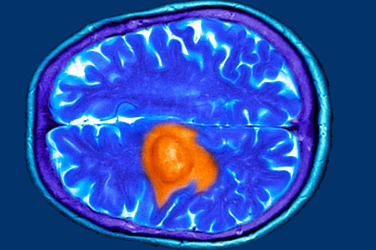 Scientists make significant brain breakthrough — and it could change how humans treat diseases