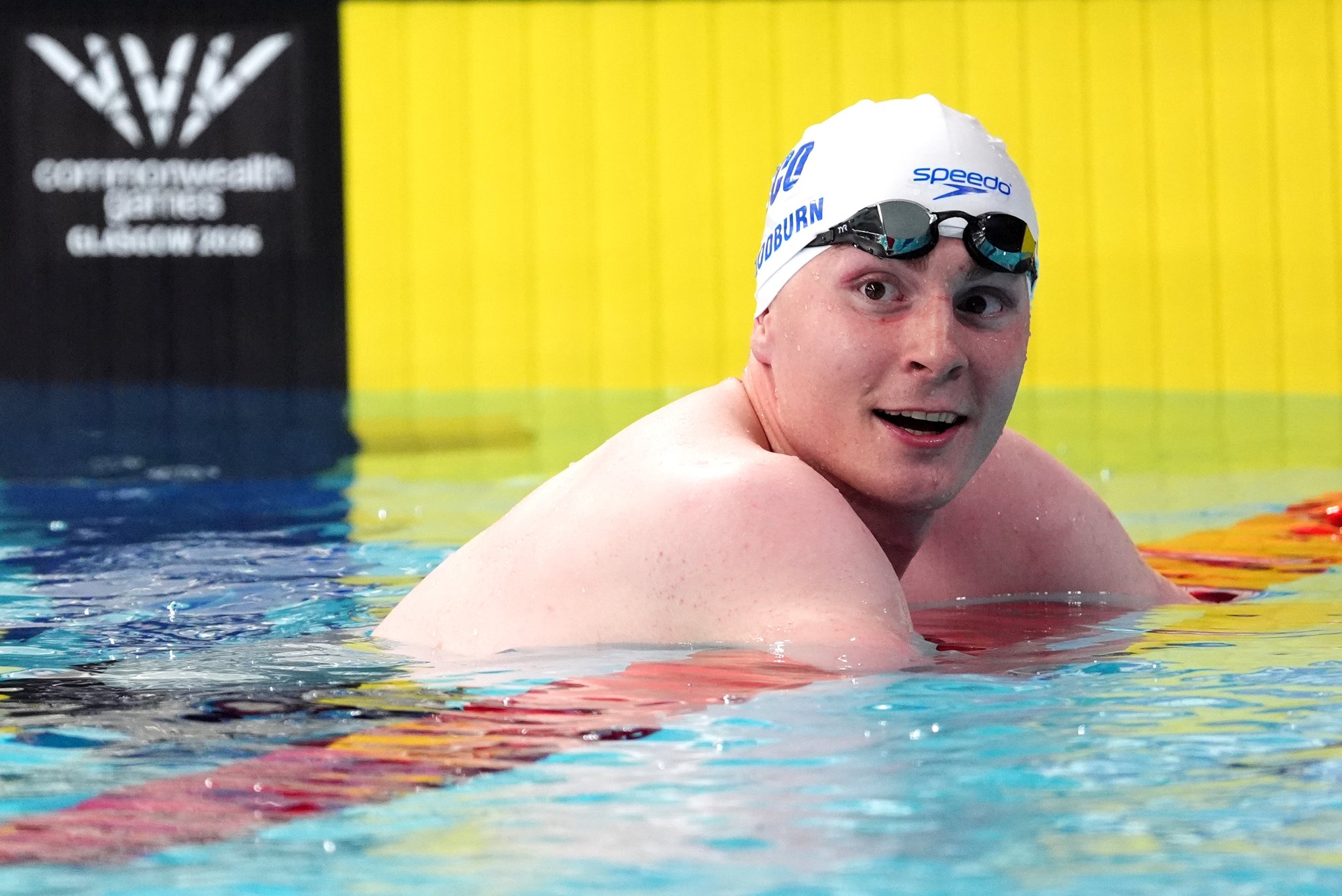 Scottish swimmer to meet Andy Burnham in plea for more cancer funding